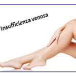 insufvenosa